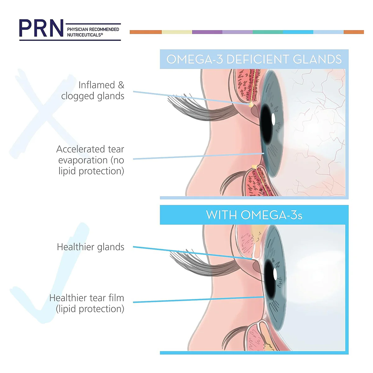 PRN DE3 Dry Eye Omega Benefits® (90/180/270ct. 1-3 Month Supply) - Image 5