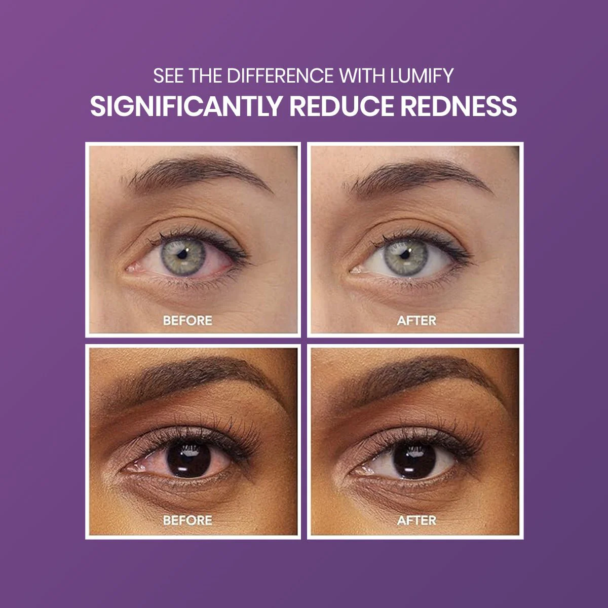 Lumify Eye Drops 2.5mL or 7.5mL (1 or 3 Month Supplies) - Image 4