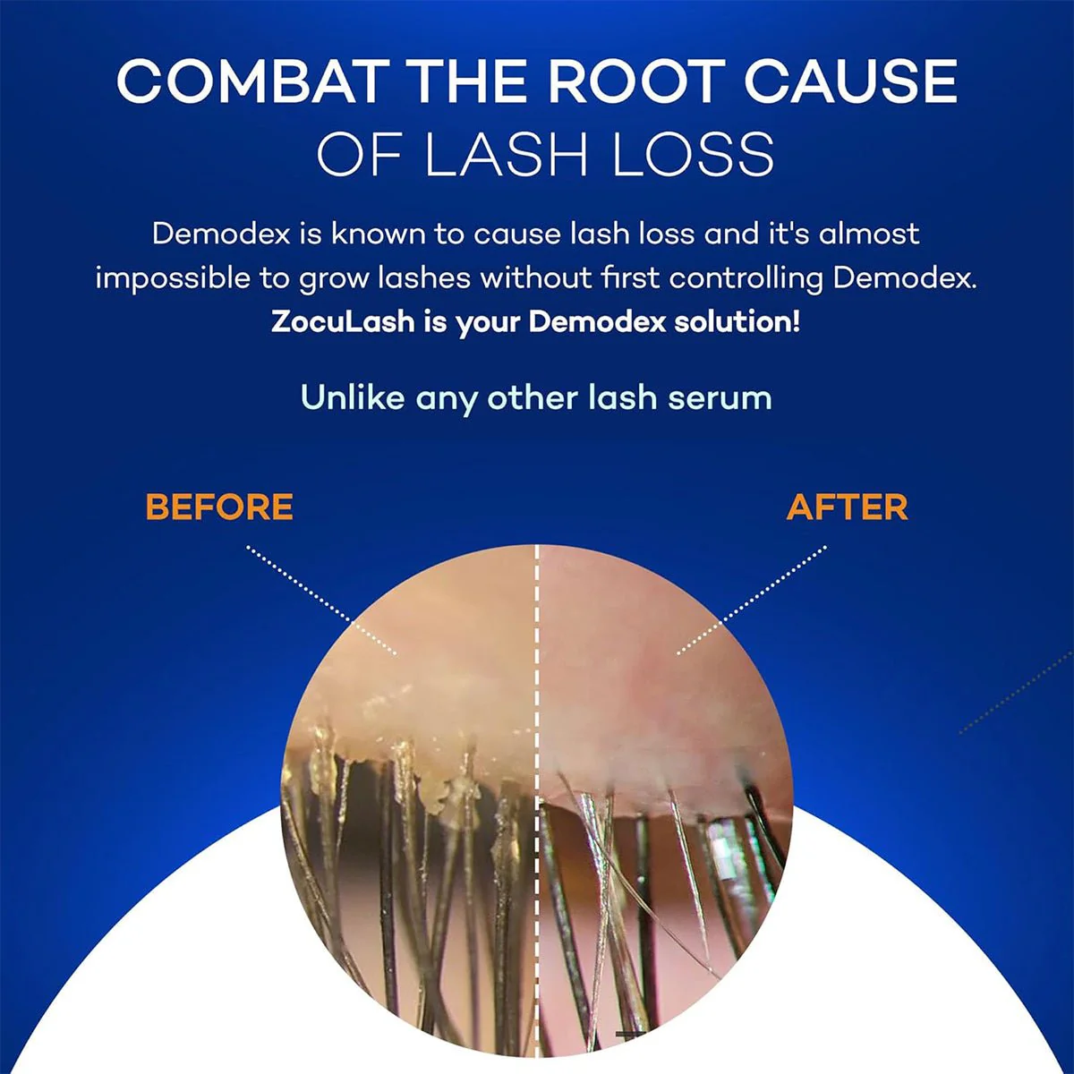 ZocuLash Eyelash Enhancing Serum (2.5mL) - Image 4